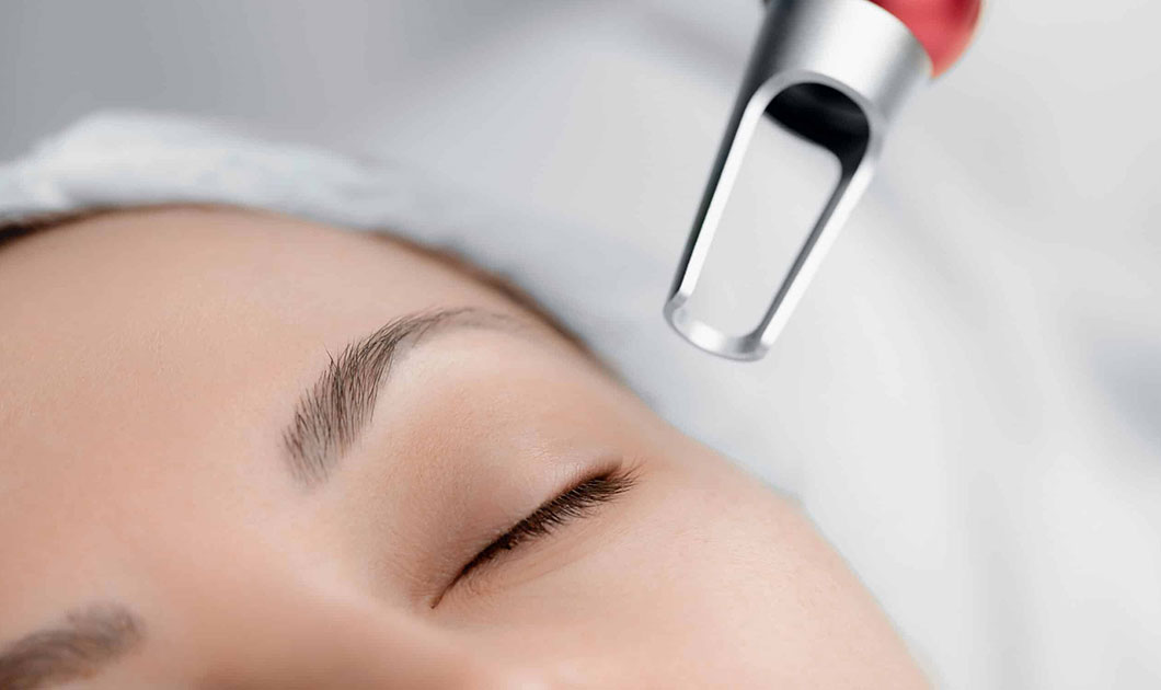 laser face treatments