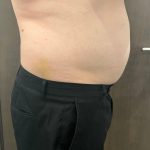 Mix & Match (Iyashi, Bodytone, Presso Therapy, Wonder, Roller Shaper)