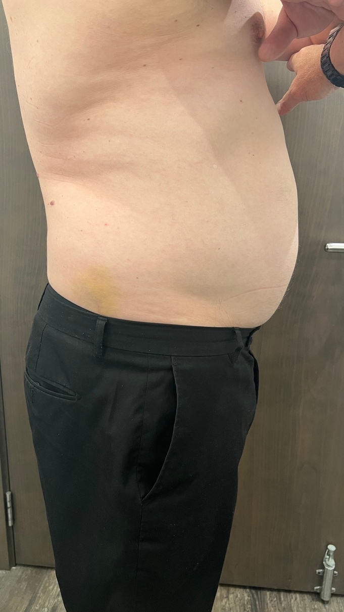 Mix & Match (Iyashi, Bodytone, Presso Therapy, Wonder, Roller Shaper)