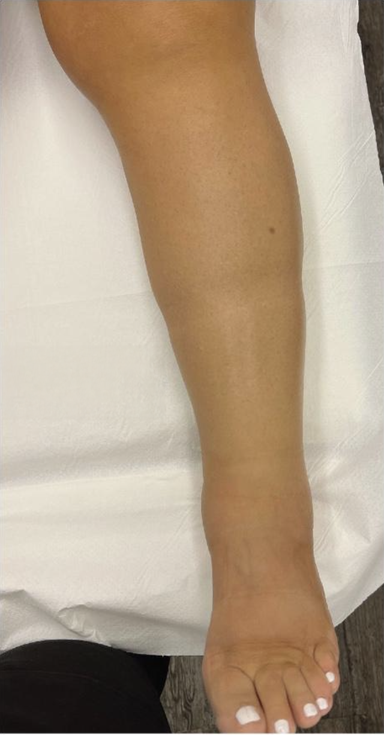 Lymphatic Massage (3 Sessions)