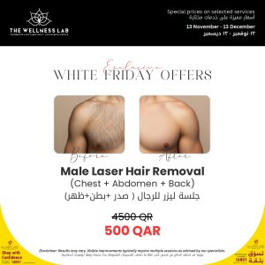 TWL-WhiteFriday-Offer-v1_page-0003