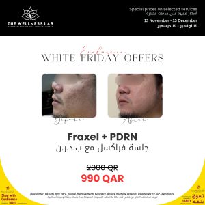 TWL-WhiteFriday-Offer-v1_page-0011