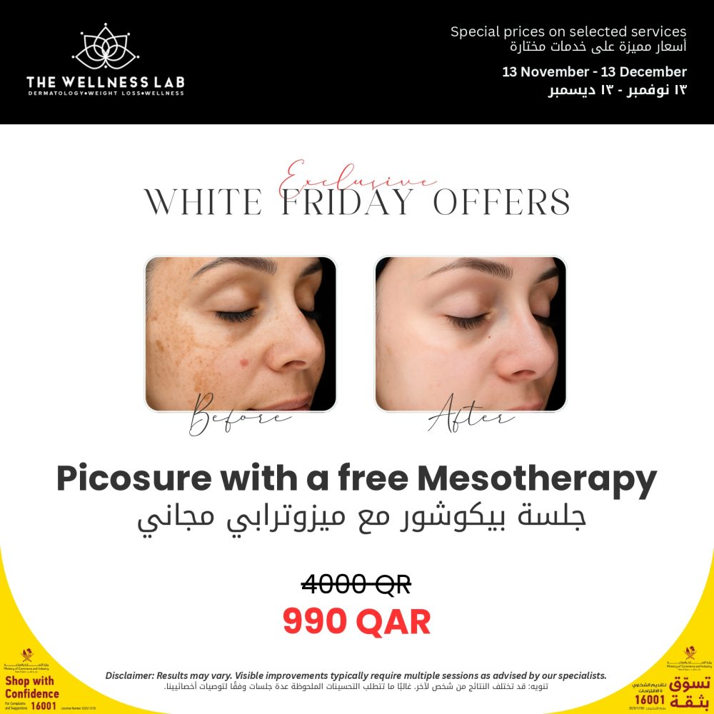 Picosure + Free Mesotherapy