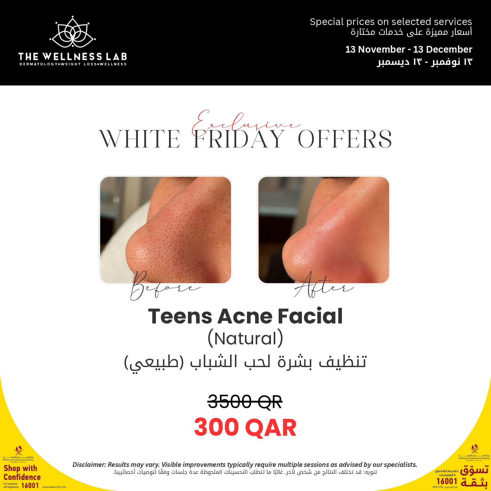 TWL-WhiteFriday-Offer-v1_page-0013