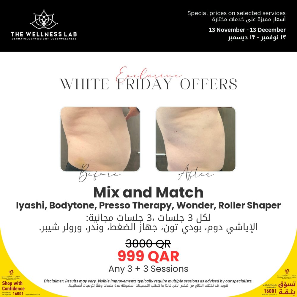 Mix & Match (Iyashi, Bodytone, Presso Therapy, Wonder, Roller Shaper)