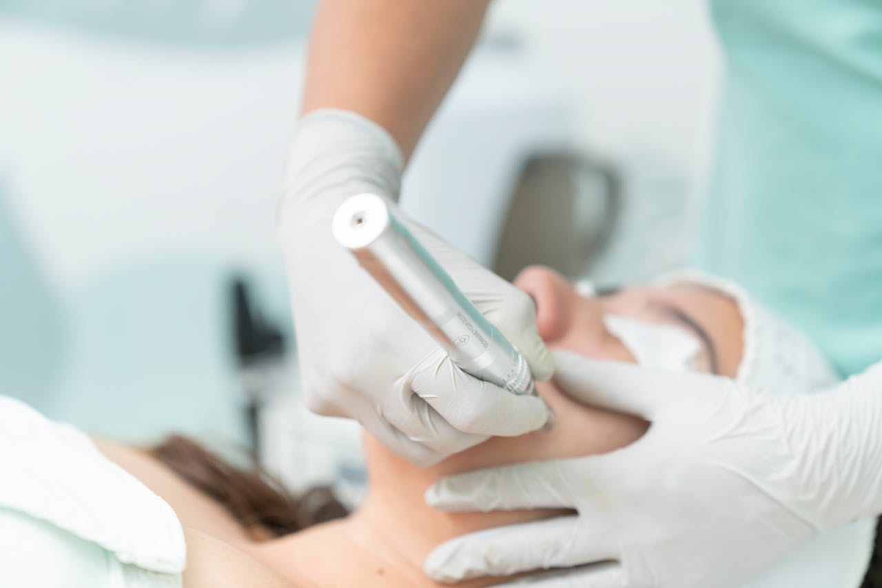 Acne facial in Qatar Treatment