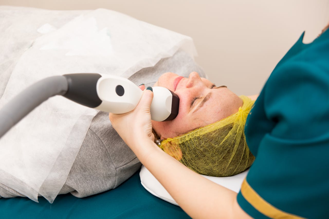 Carbon laser facial Treatment