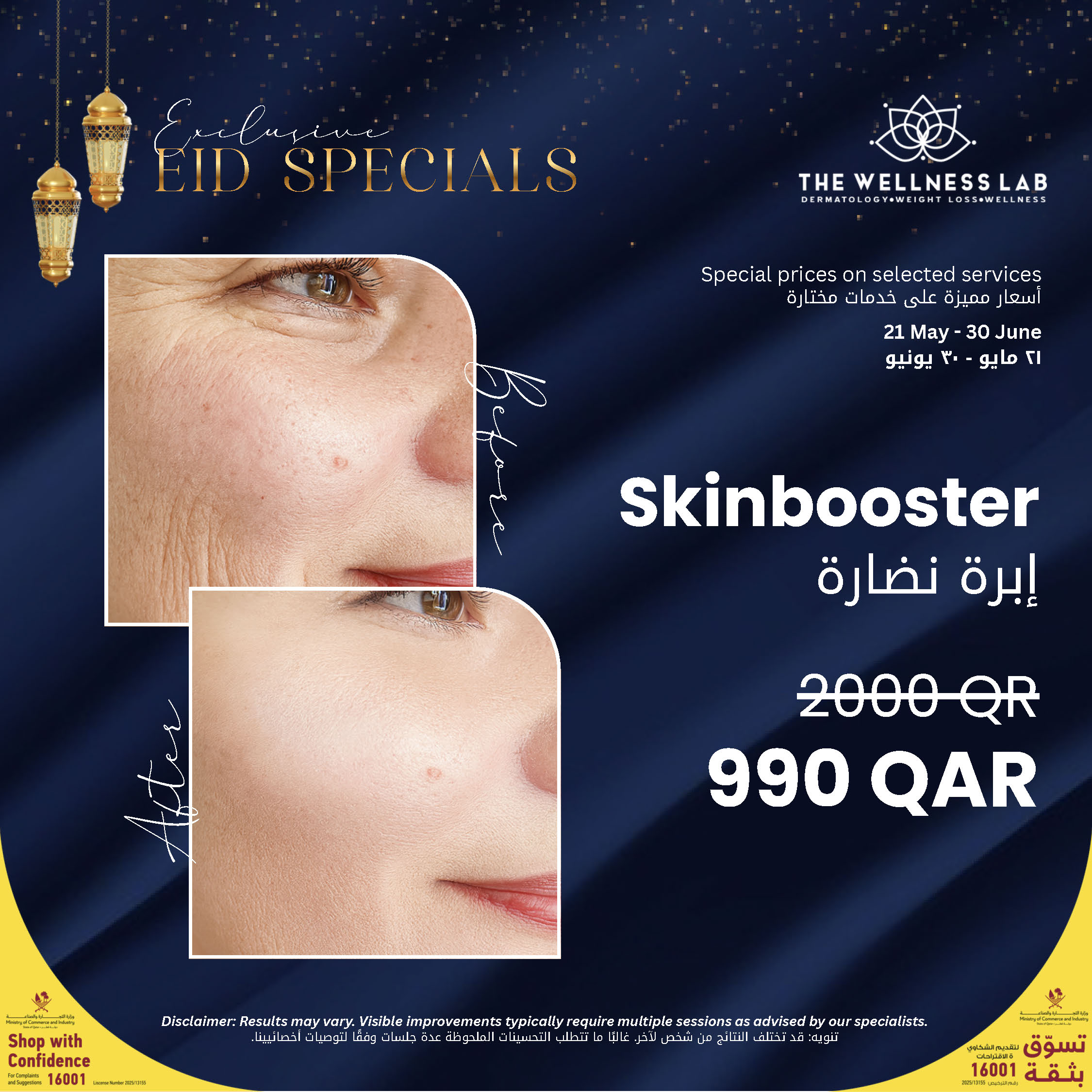Skinbooster