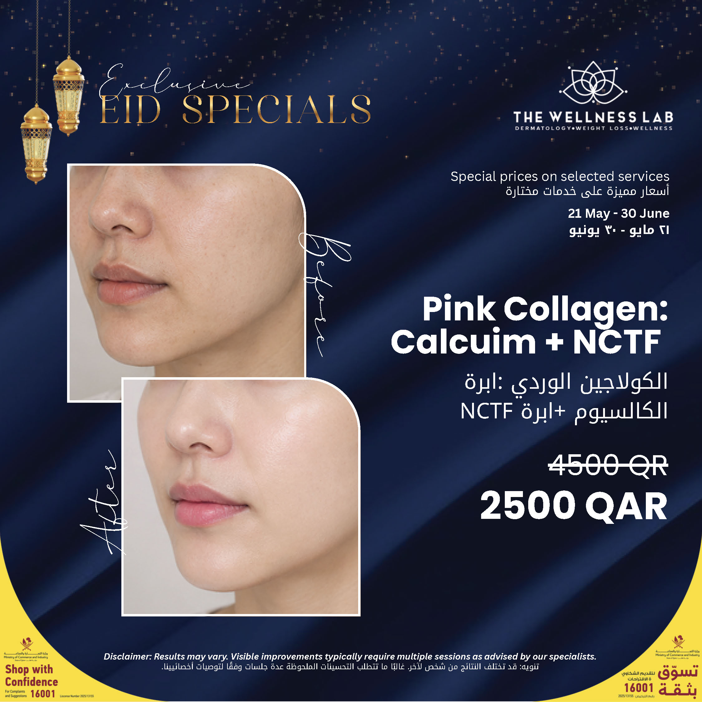 Pink Collagen: Calcium NCTF